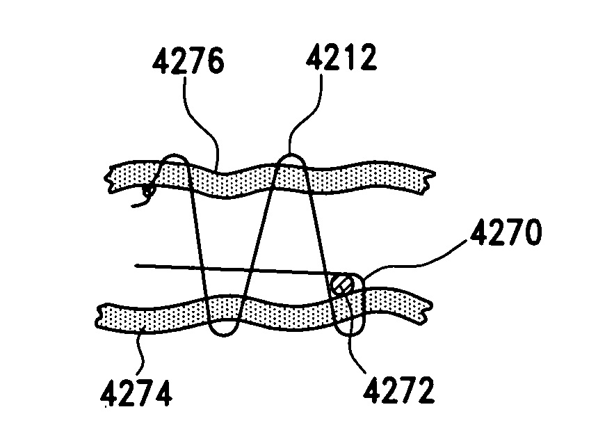 Method for suture lacing