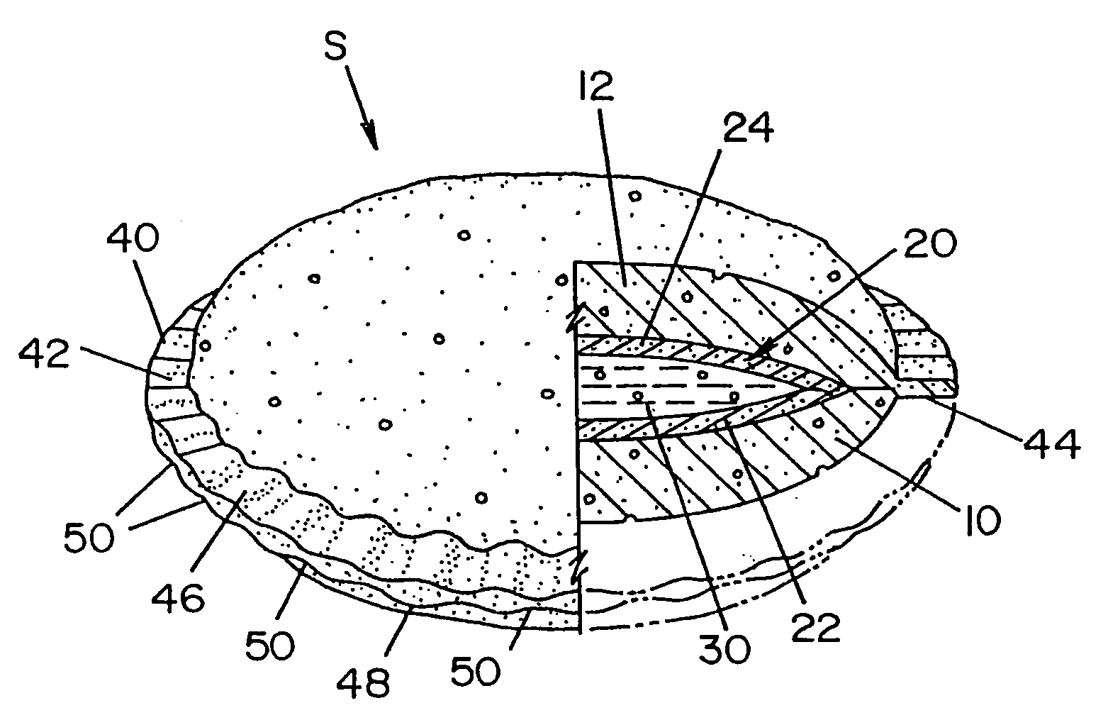 Method and apparatus for making commercial crustless sandwiches and the crustless sandwich made thereby