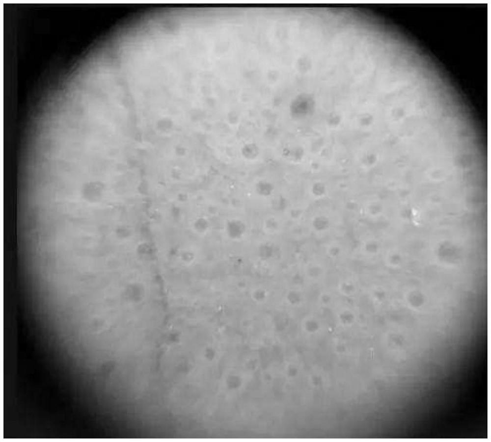 Iodized oil embolism agent containing adriamycin and preparation method of iodized oil embolism agent