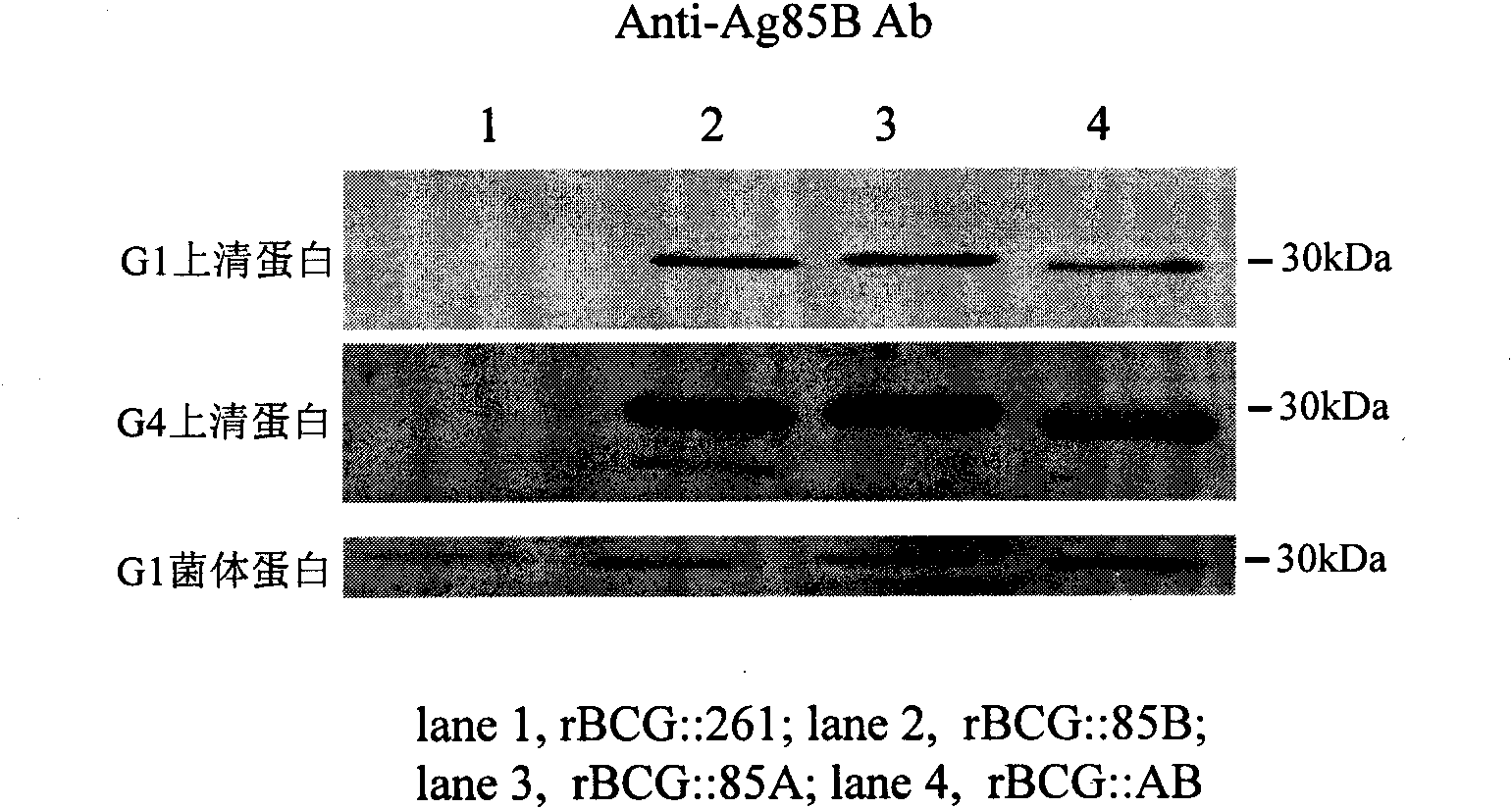 Recombination BCG vaccine rBCG::AB