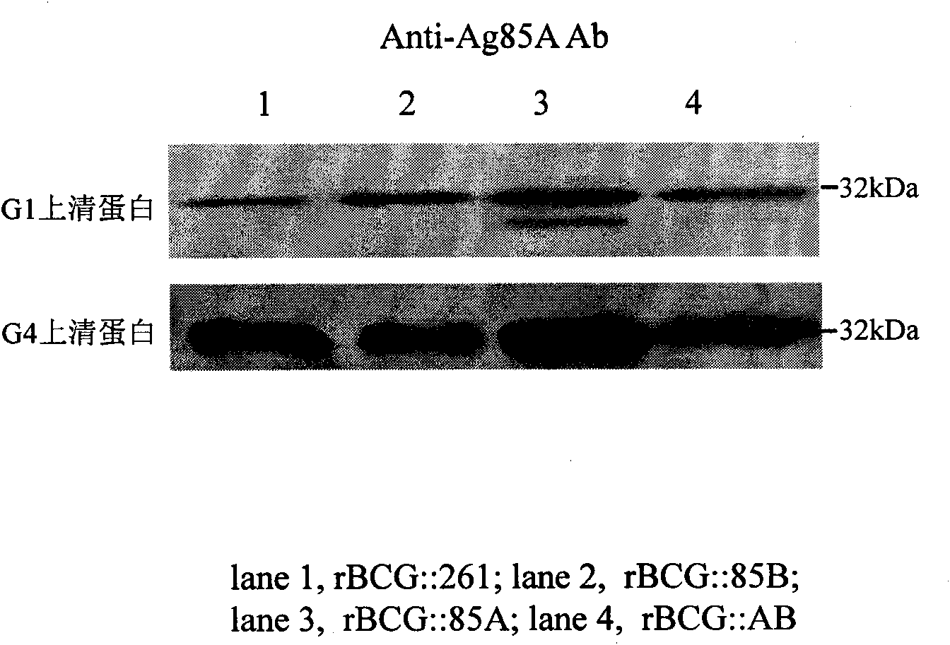 Recombination BCG vaccine rBCG::AB