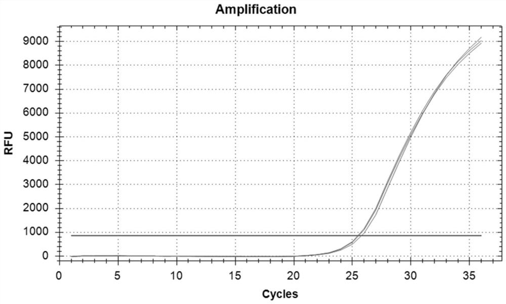 Nucleic acid molecule, PCR primer pair and kit for detecting beta-tubulin gene of trichomonad