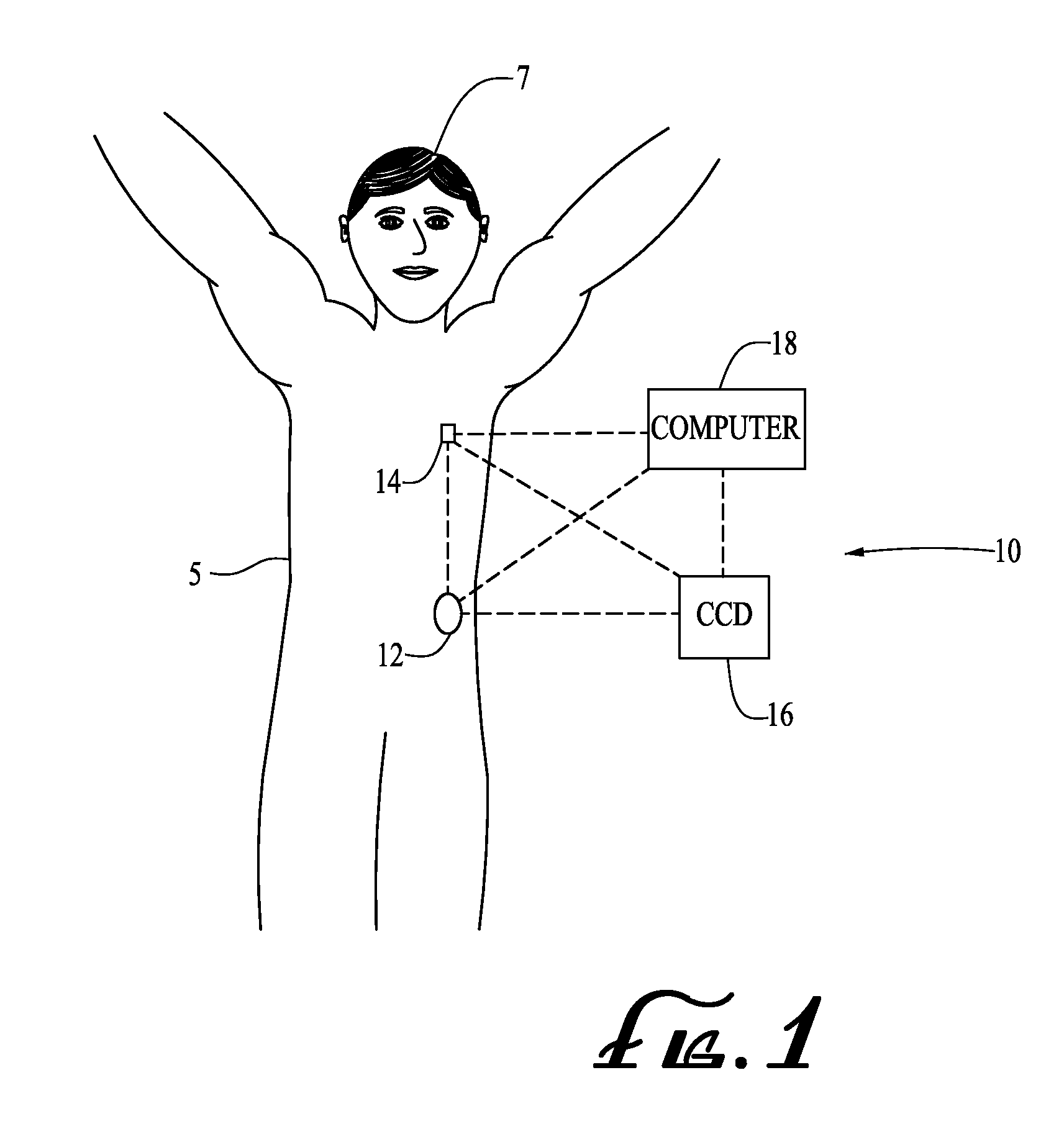 Reservoir Pressure Equalization Systems and Methods