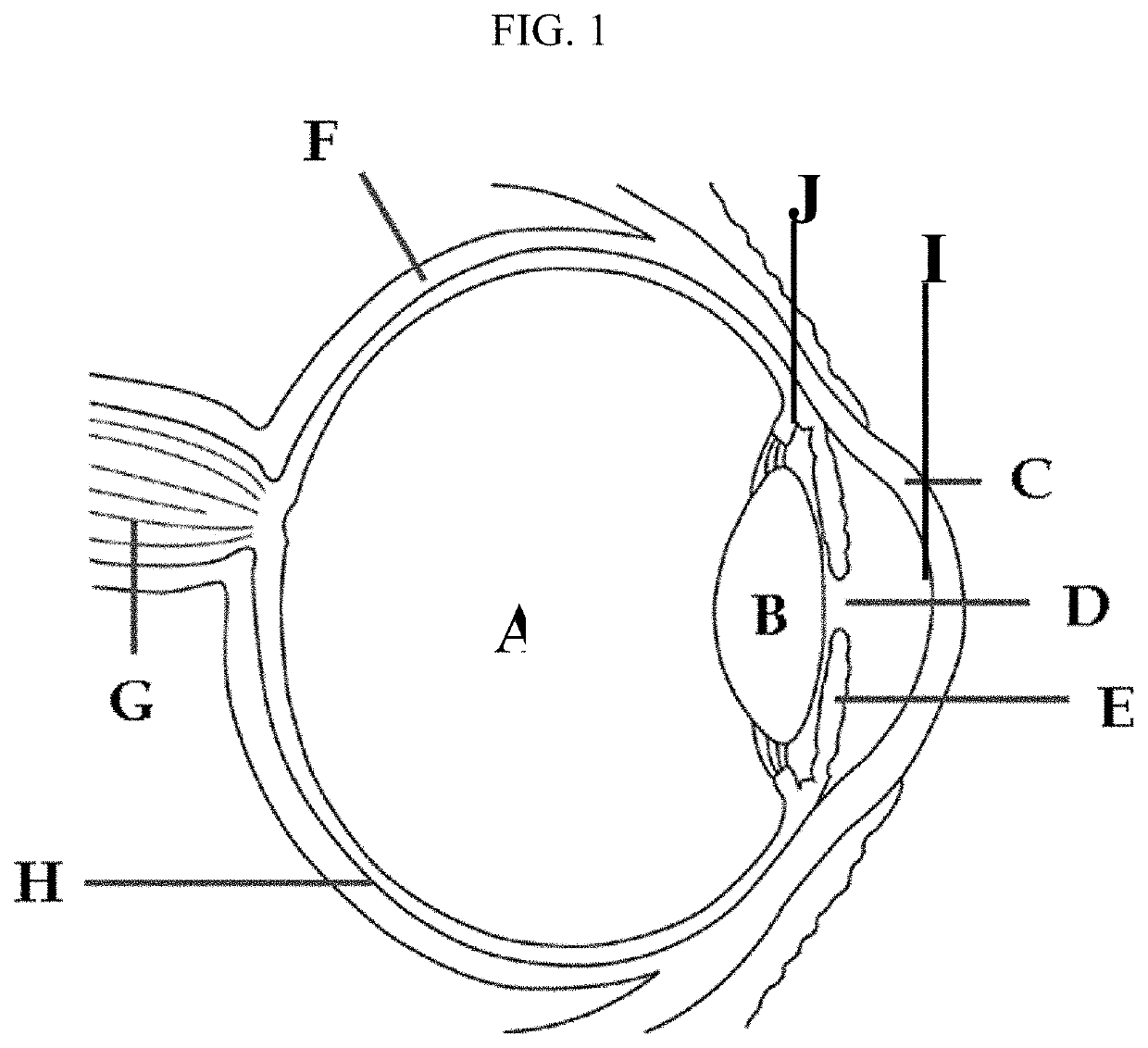 Methods for the treatment of myopia