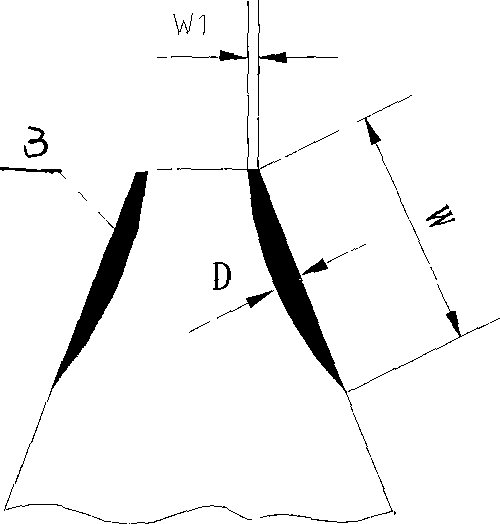 Tooth ring tooth surface laser induration processing method