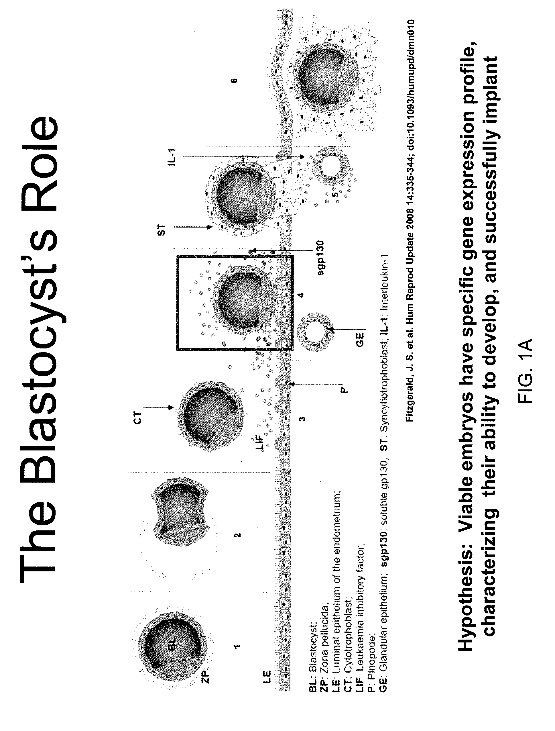 Gene Expression Profile-Facilitated In Vitro Fertilization