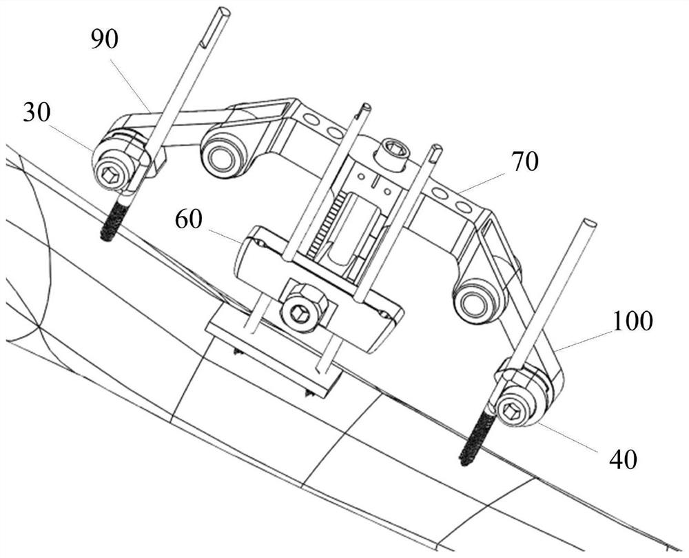 Transverse bone moving device