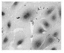 Construction method for human amniotic epithelial cells and silk fibroin support complexus