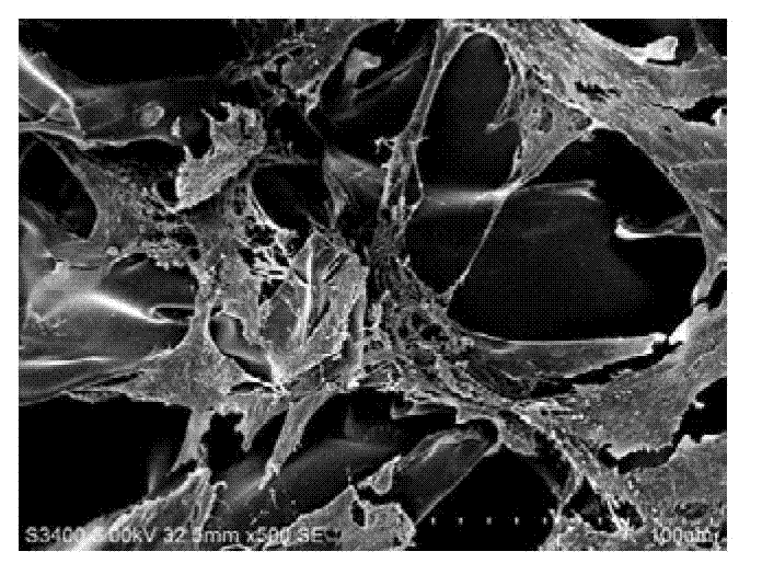 Construction method for human amniotic epithelial cells and silk fibroin support complexus