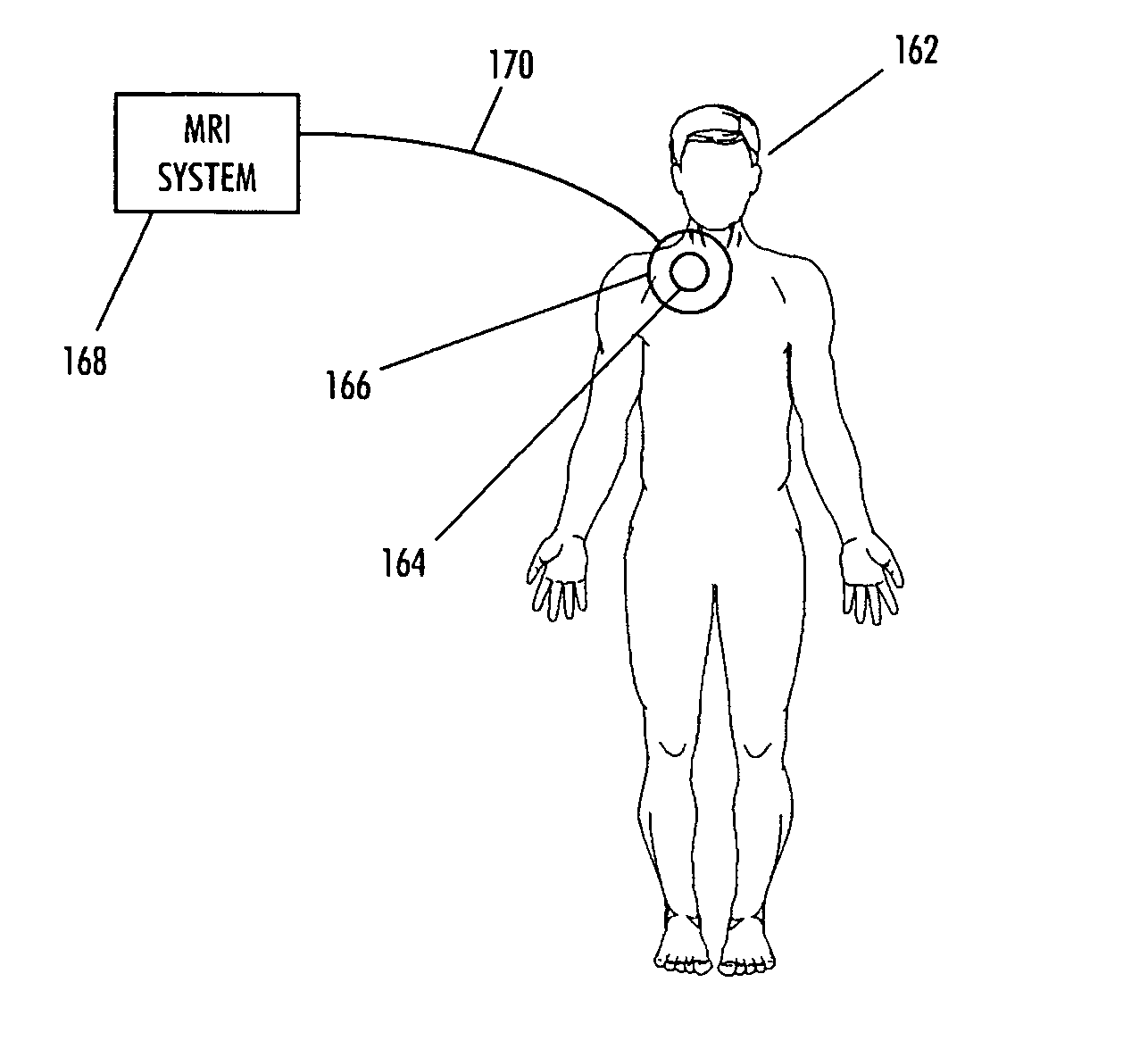 Magnetic resonance imaging interference immune device