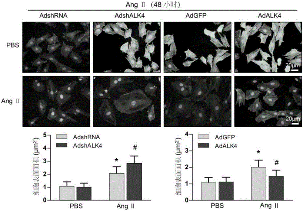 Functions and application of activin receptor-like kinase 4 in treatment of cardiac hypertrophy