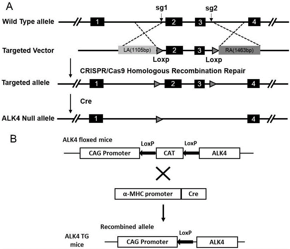 Functions and application of activin receptor-like kinase 4 in treatment of cardiac hypertrophy