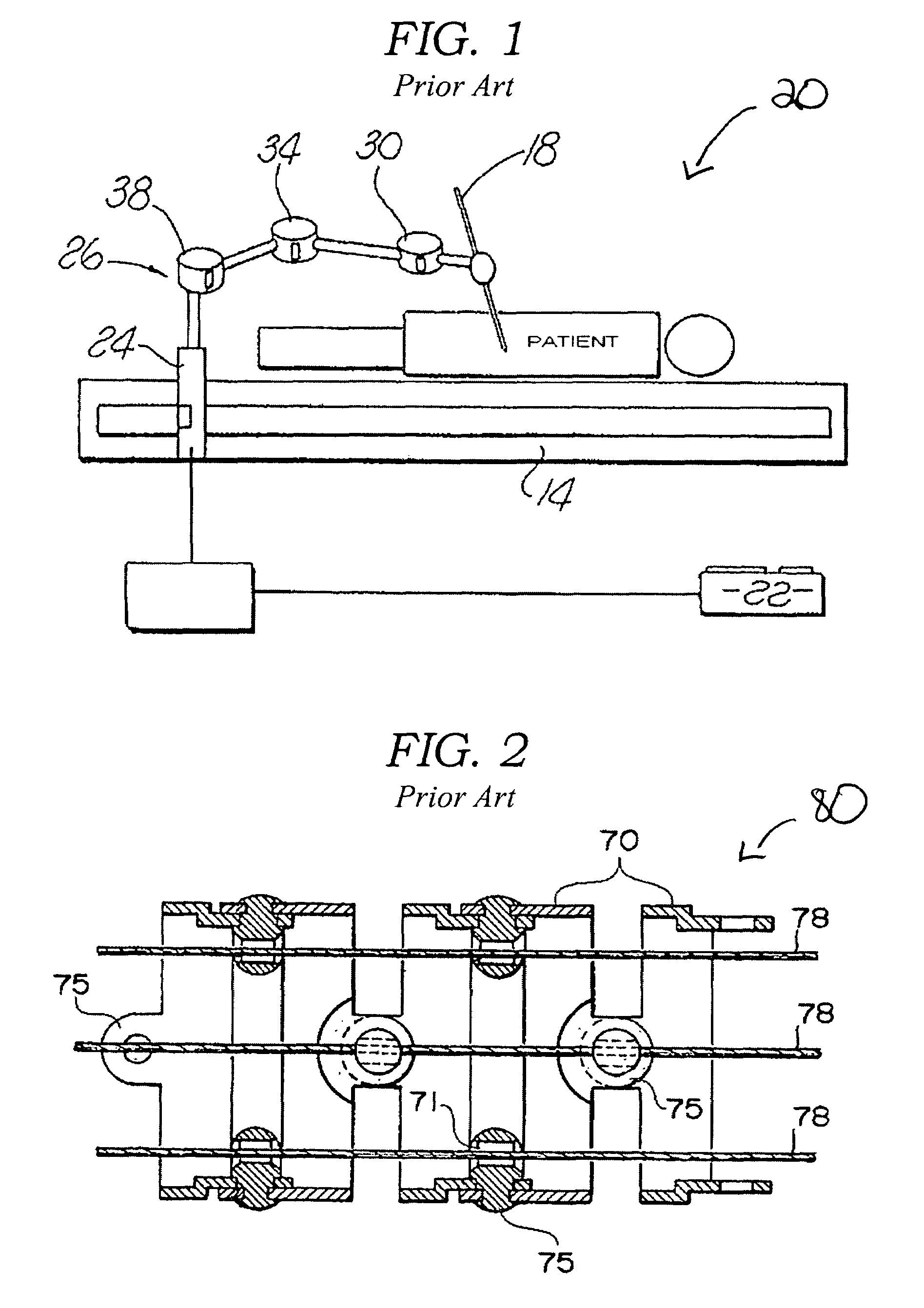 Robotized laparoscopic system