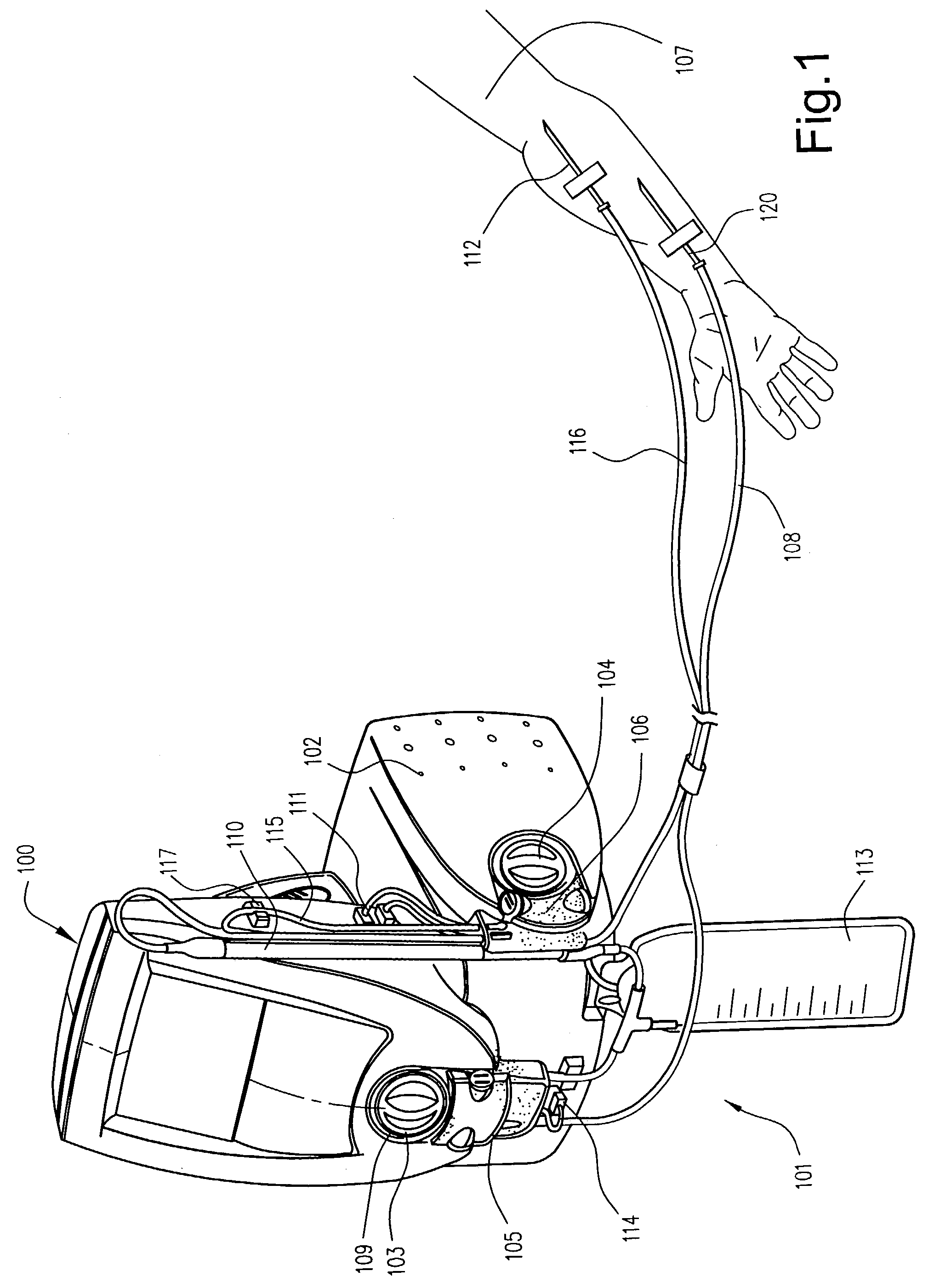 Self-loading peristaltic pump for extracorporeal blood circuit