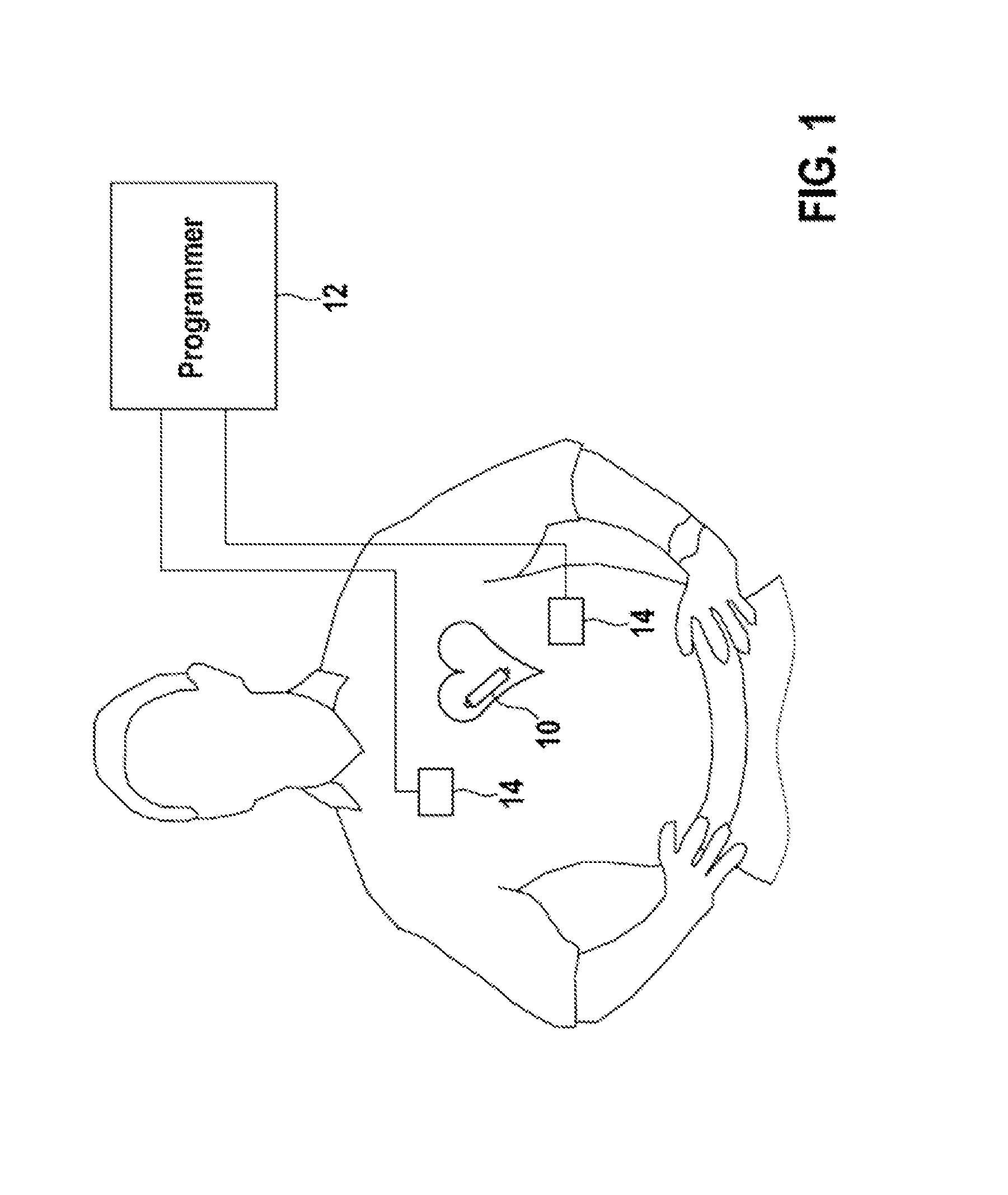 Implantable stimulation device, stimulation system and method for data communication