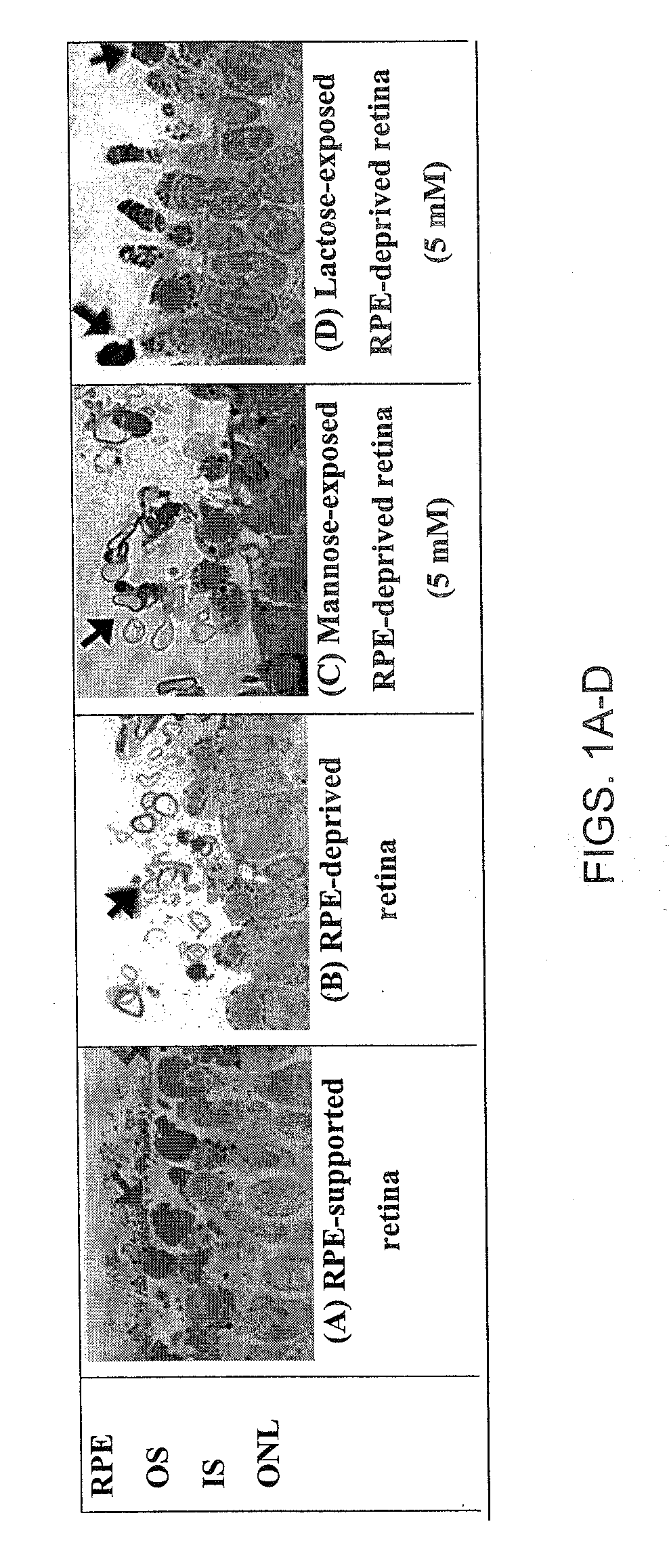 Glycan binding proteins as therapeutic targets for retinal disorders and treatment methods based thereon