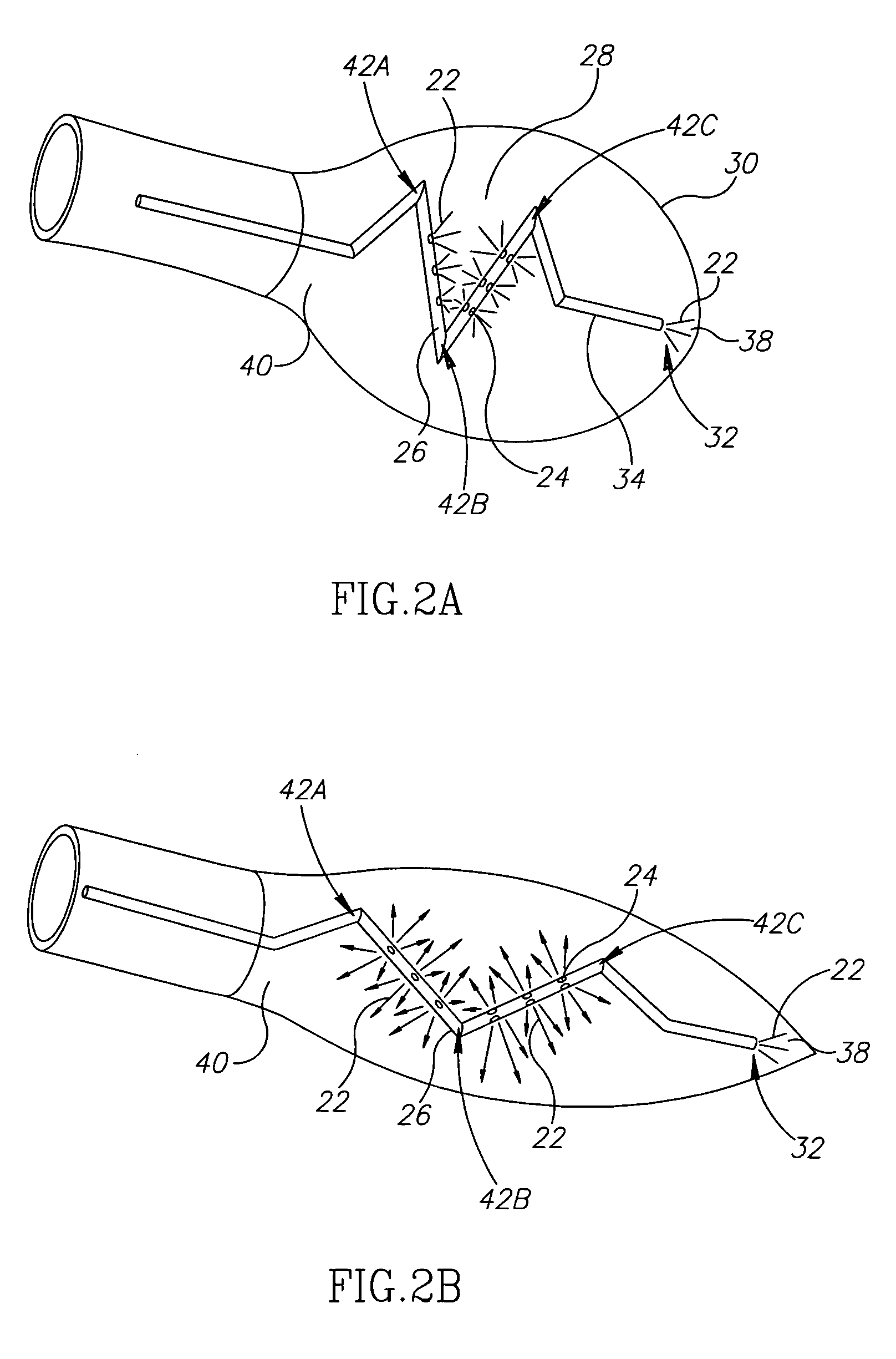 Ventricular injection catheter