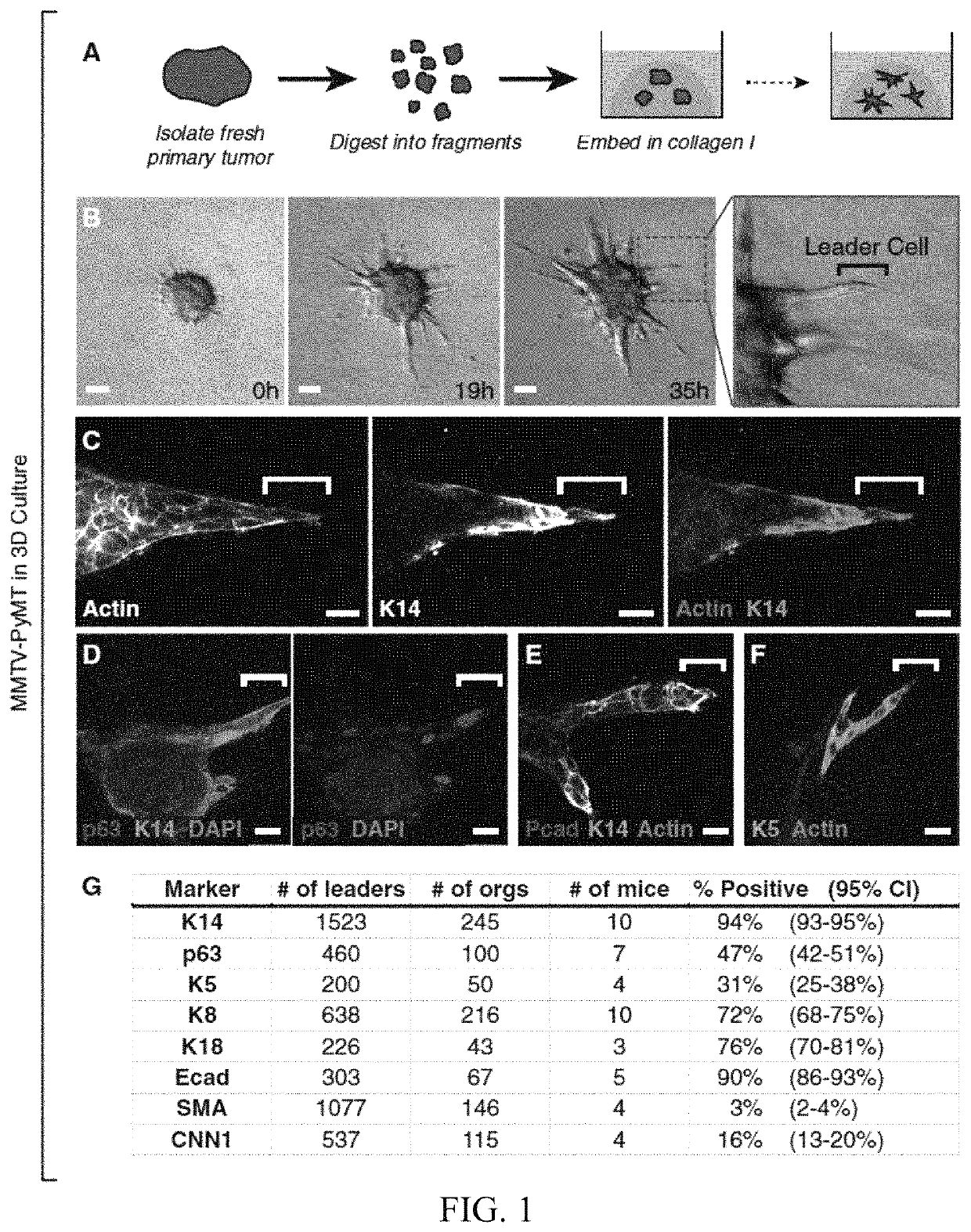 Molecular signatures of invasive cancer subpopulations