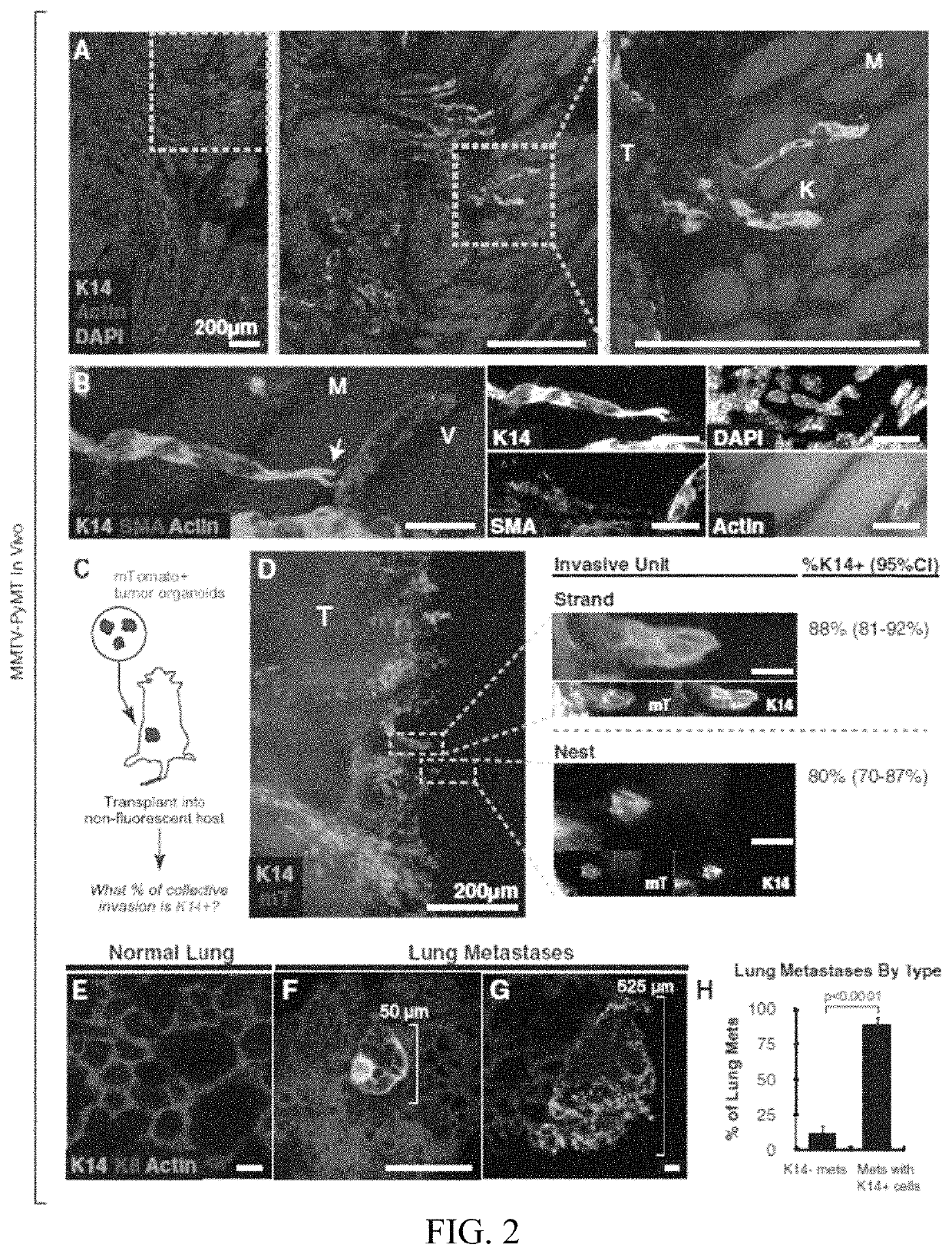 Molecular signatures of invasive cancer subpopulations