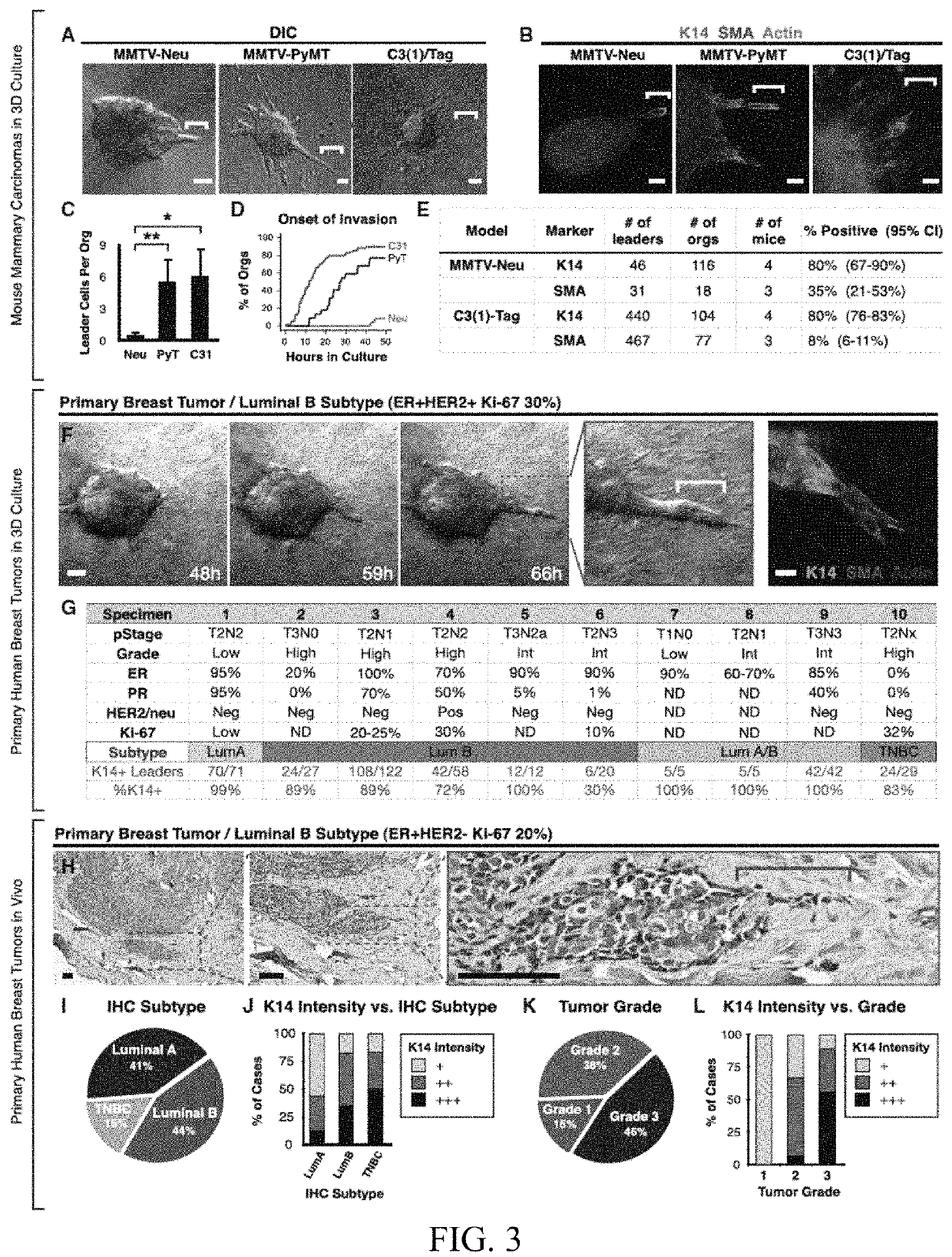 Molecular signatures of invasive cancer subpopulations