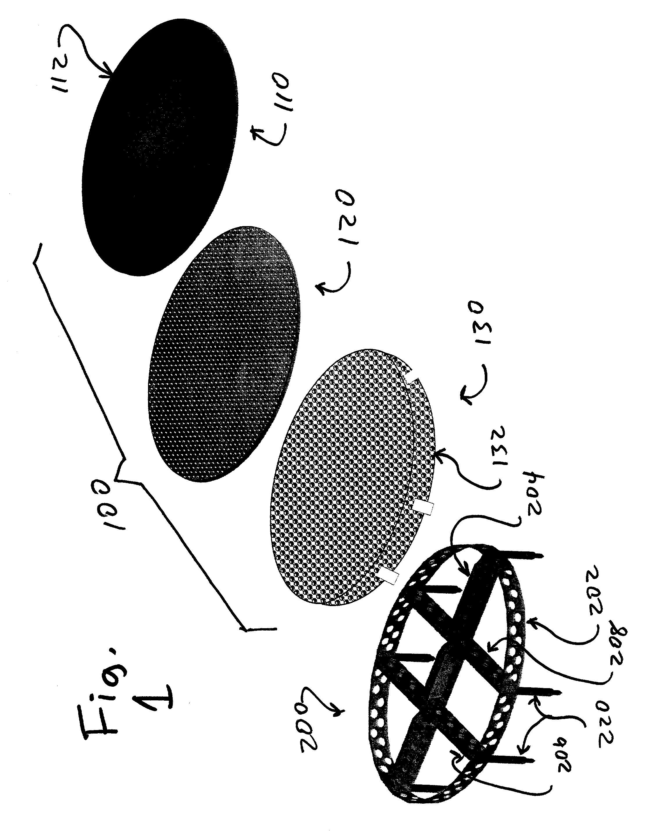 Cartilage repair implant with soft bearing surface and flexible anchoring device