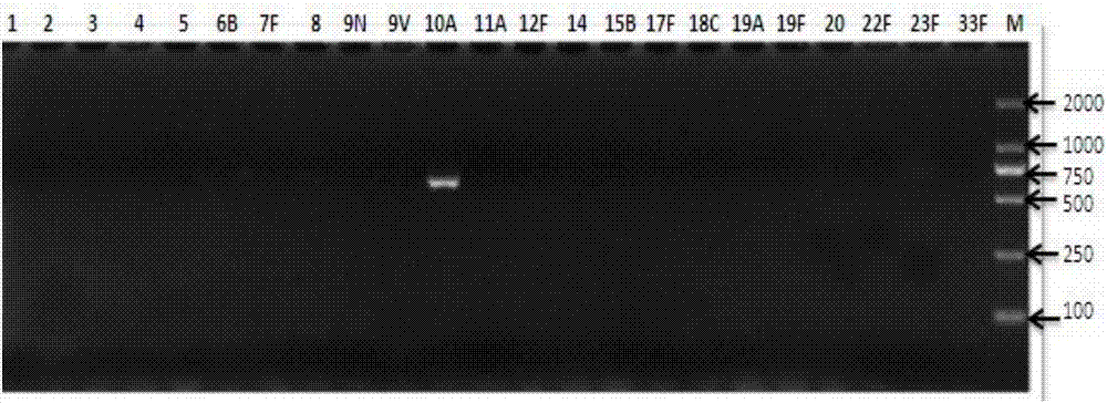 Kit for detecting pneumococcus 10A serotype