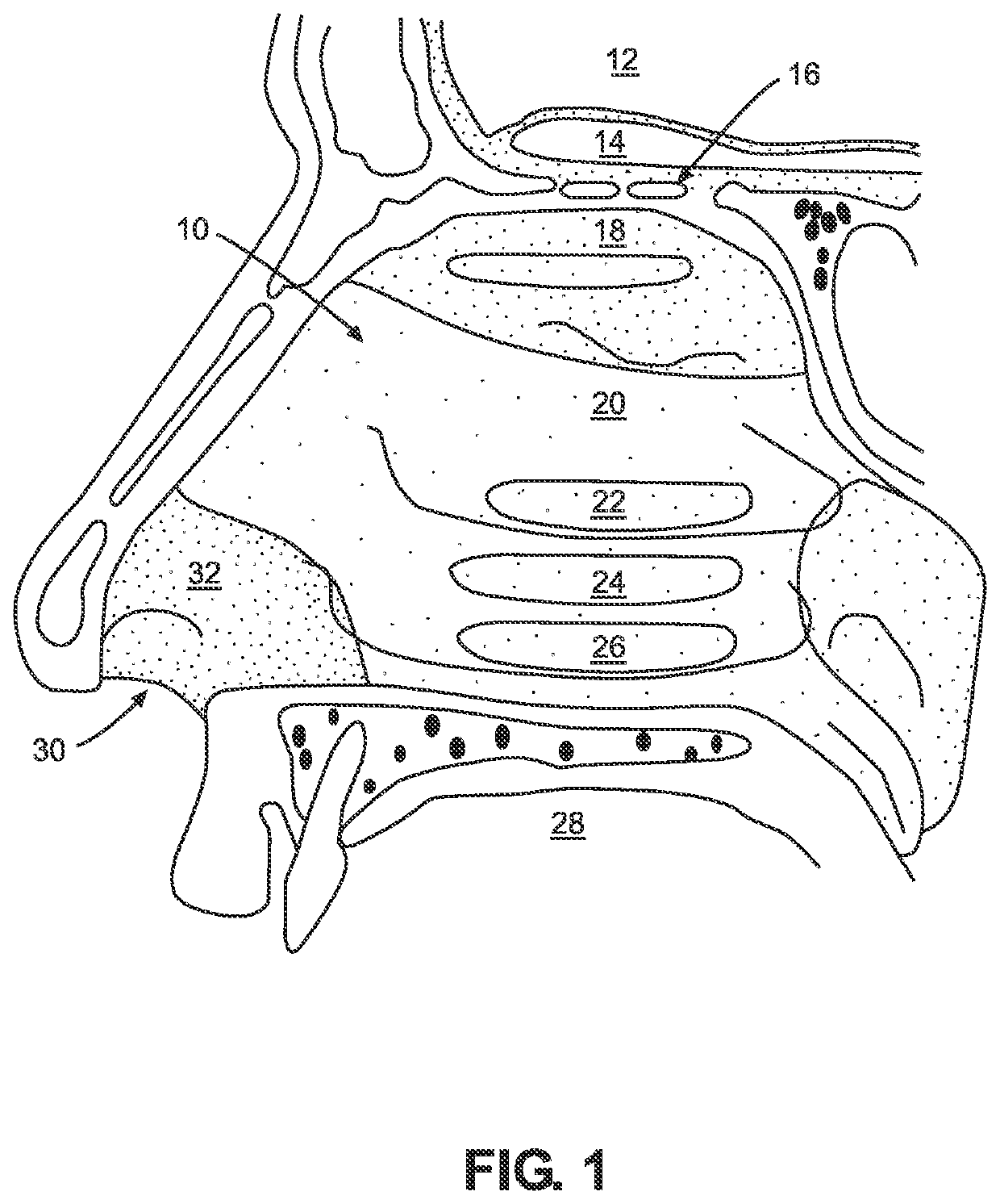 Nose cone vent design for inhalation device