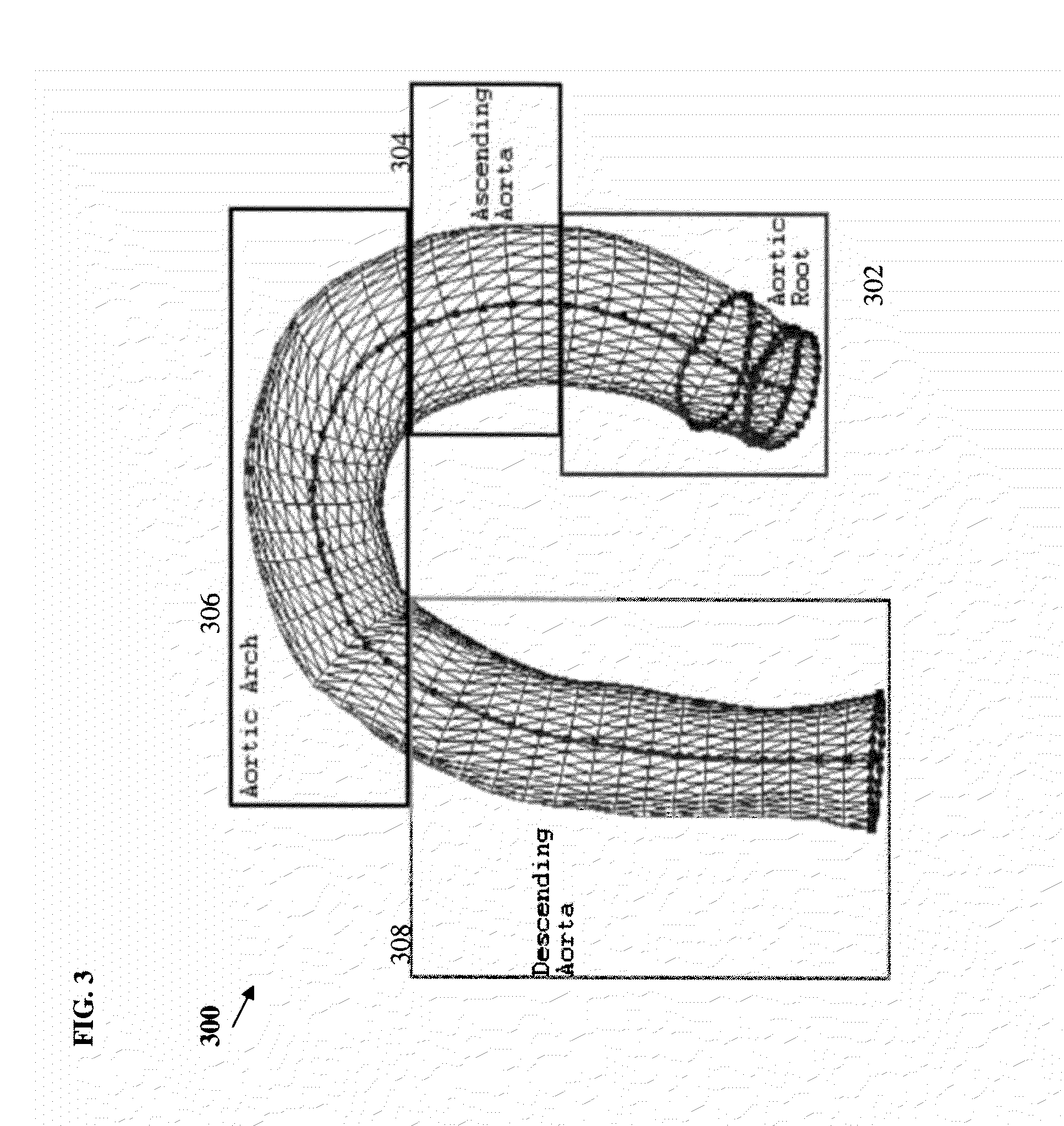 Method and System for Automatic Aorta Segmentation