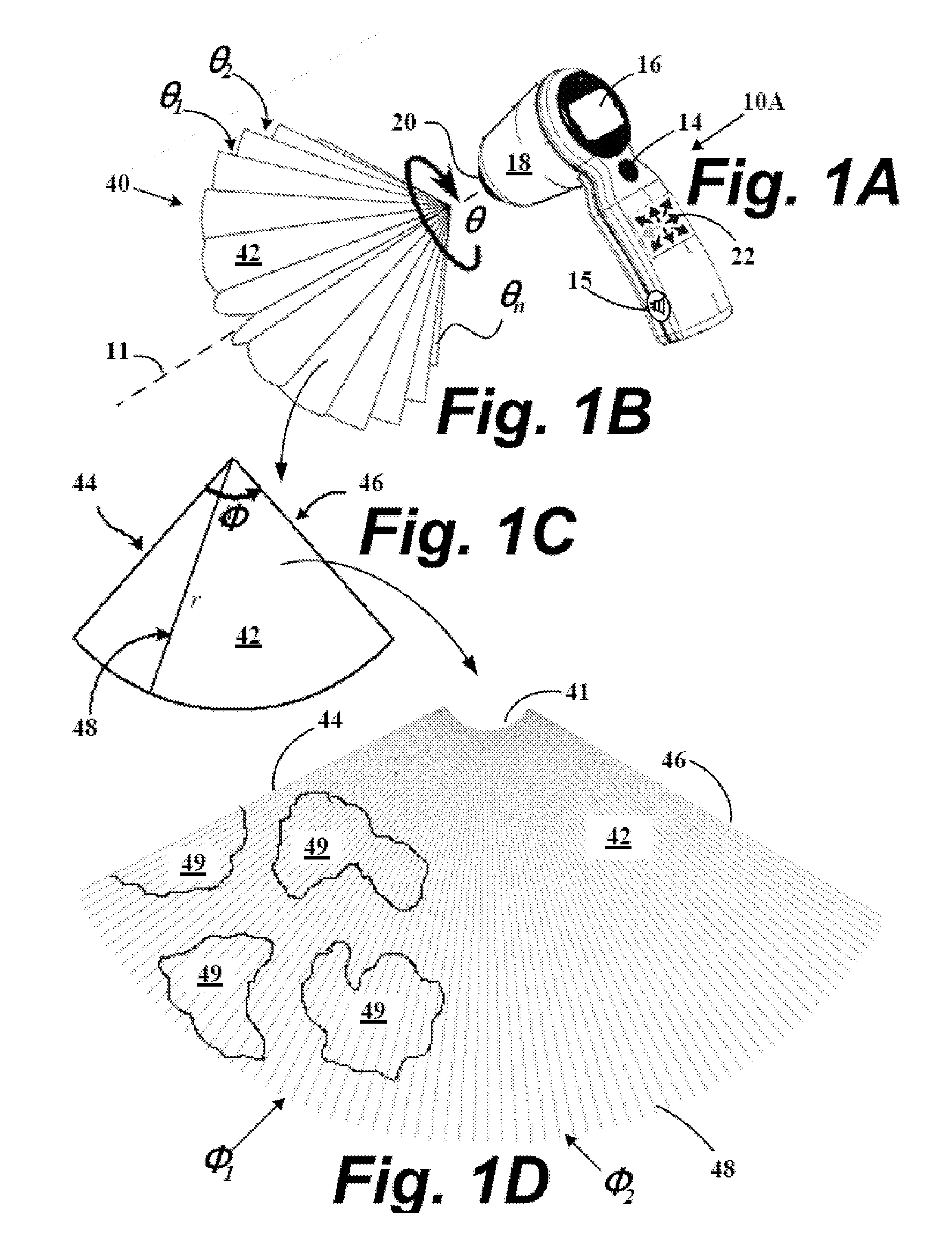 System and method to identify and measure organ wall boundaries