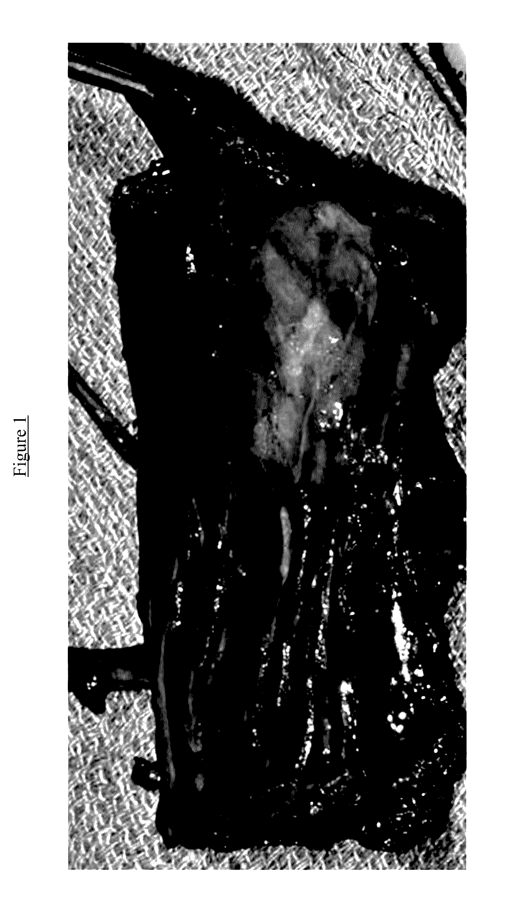 Nerve stimulation device for treating or reducing paralysis