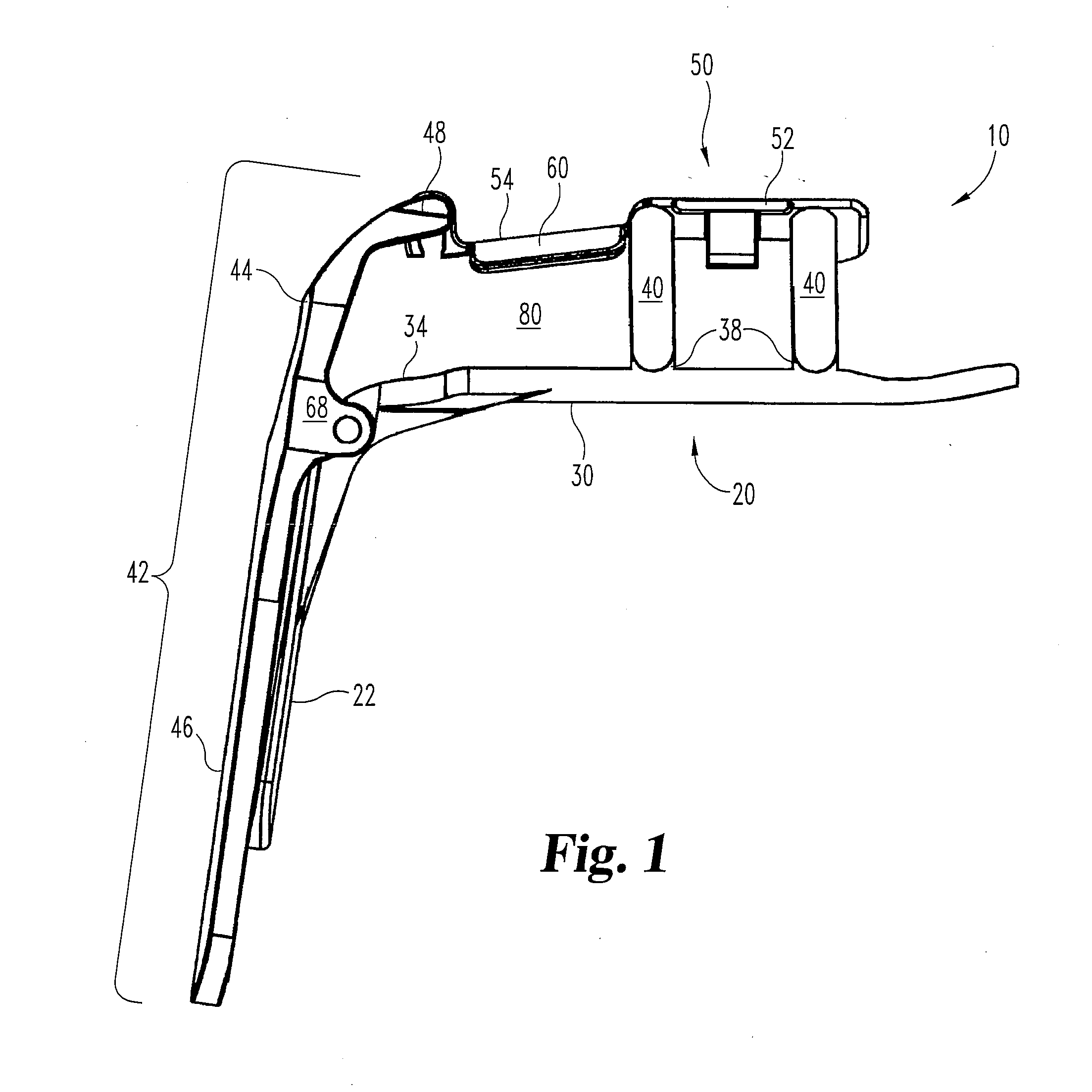 Speculum