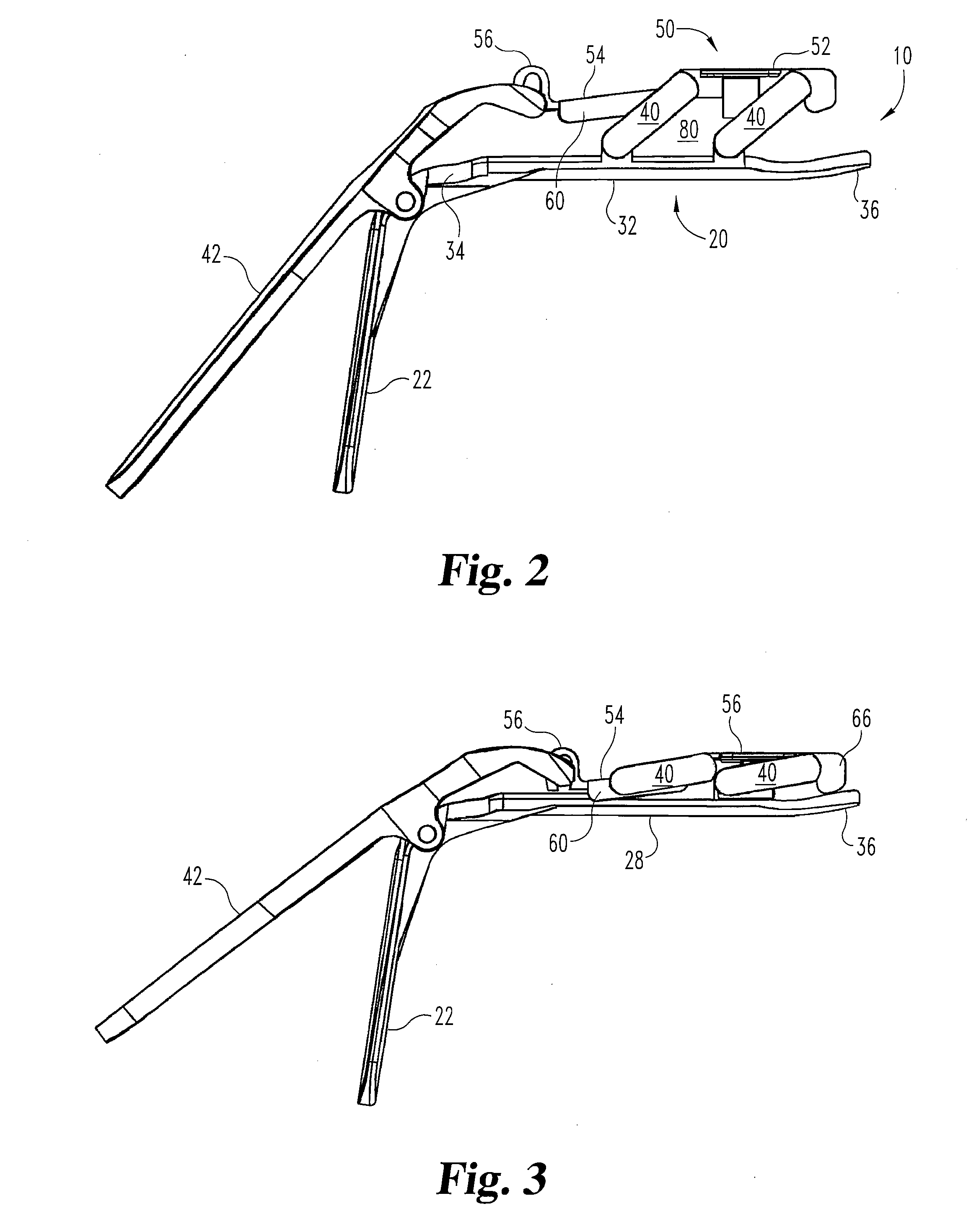 Speculum