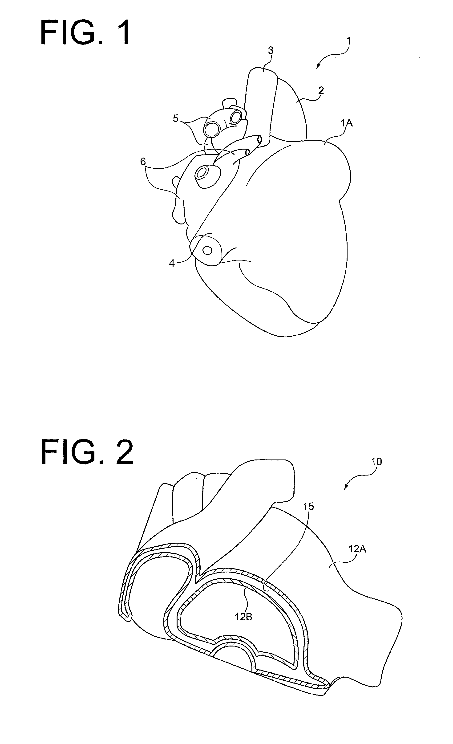 Method of producing organ model, mold for producing organ model, and organ model