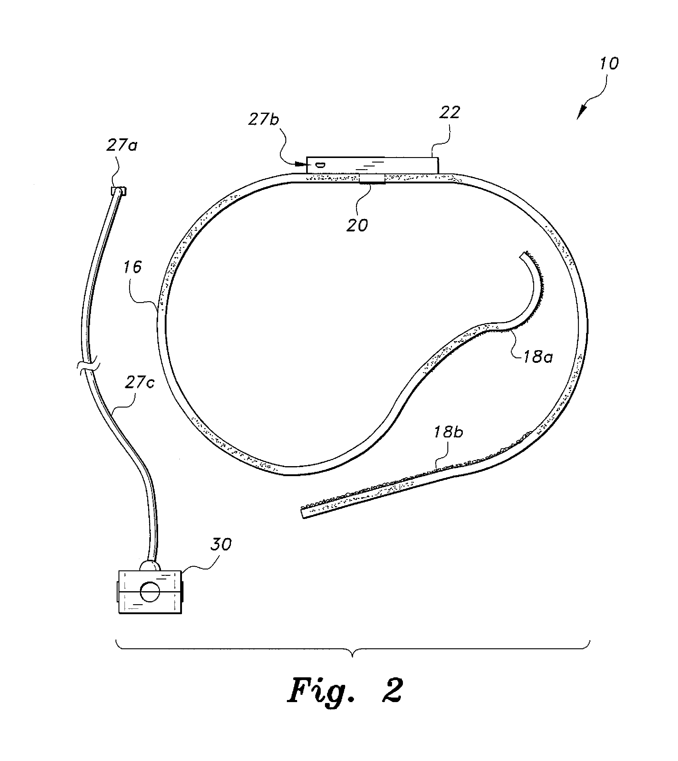 Wearable acoustic device for monitoring breathing sounds