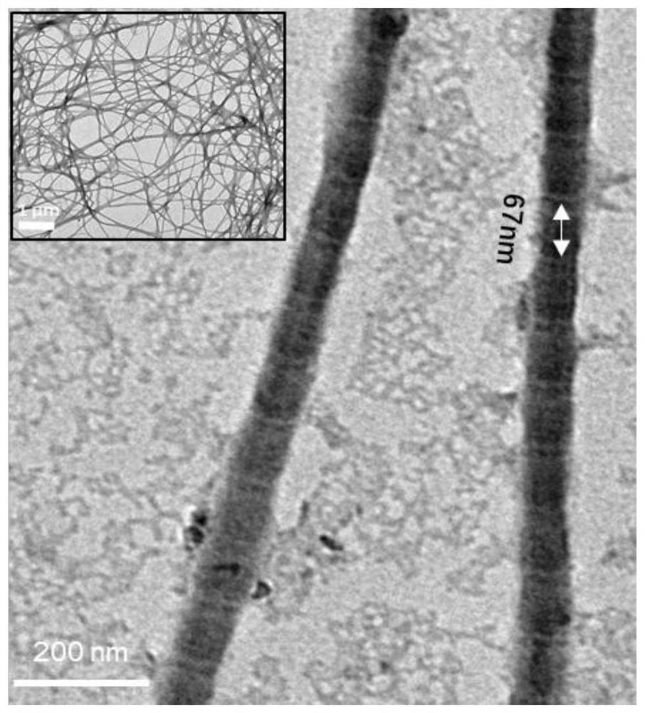 Bionic mineralized collagen gel and preparation method and application thereof