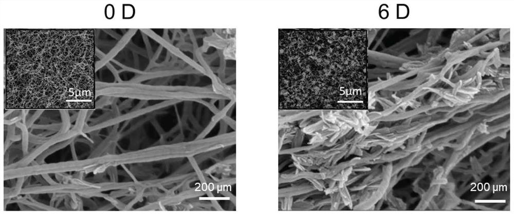 Bionic mineralized collagen gel and preparation method and application thereof