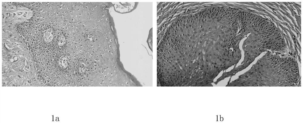 Pathological tissue section staining kit