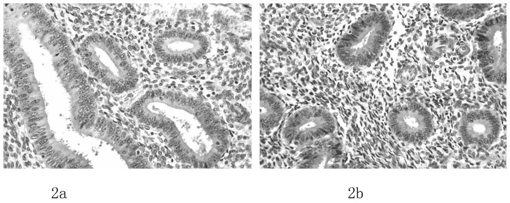 Pathological tissue section staining kit