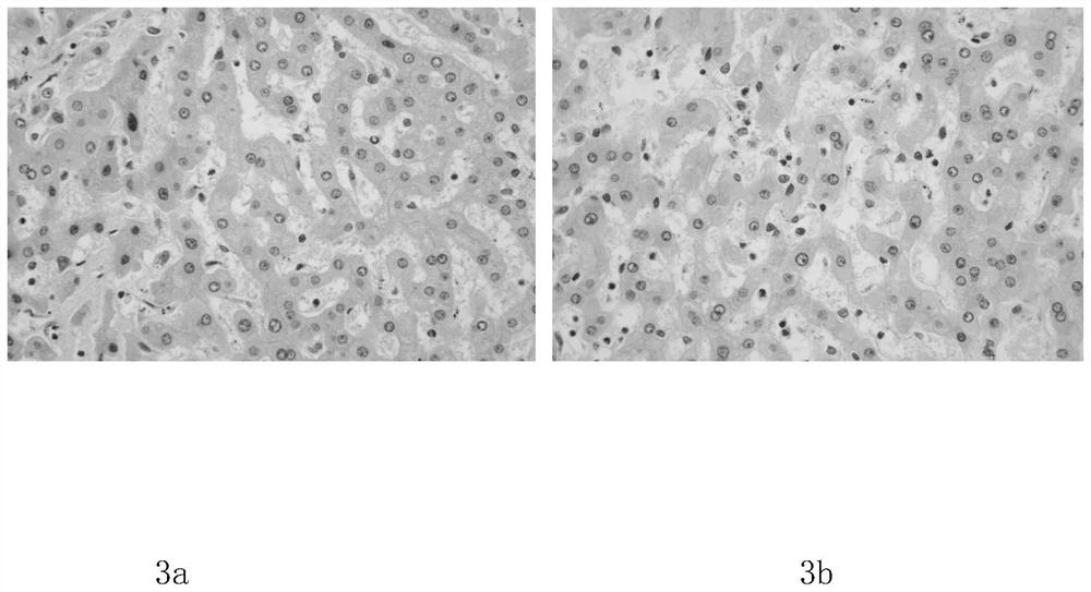 Pathological tissue section staining kit