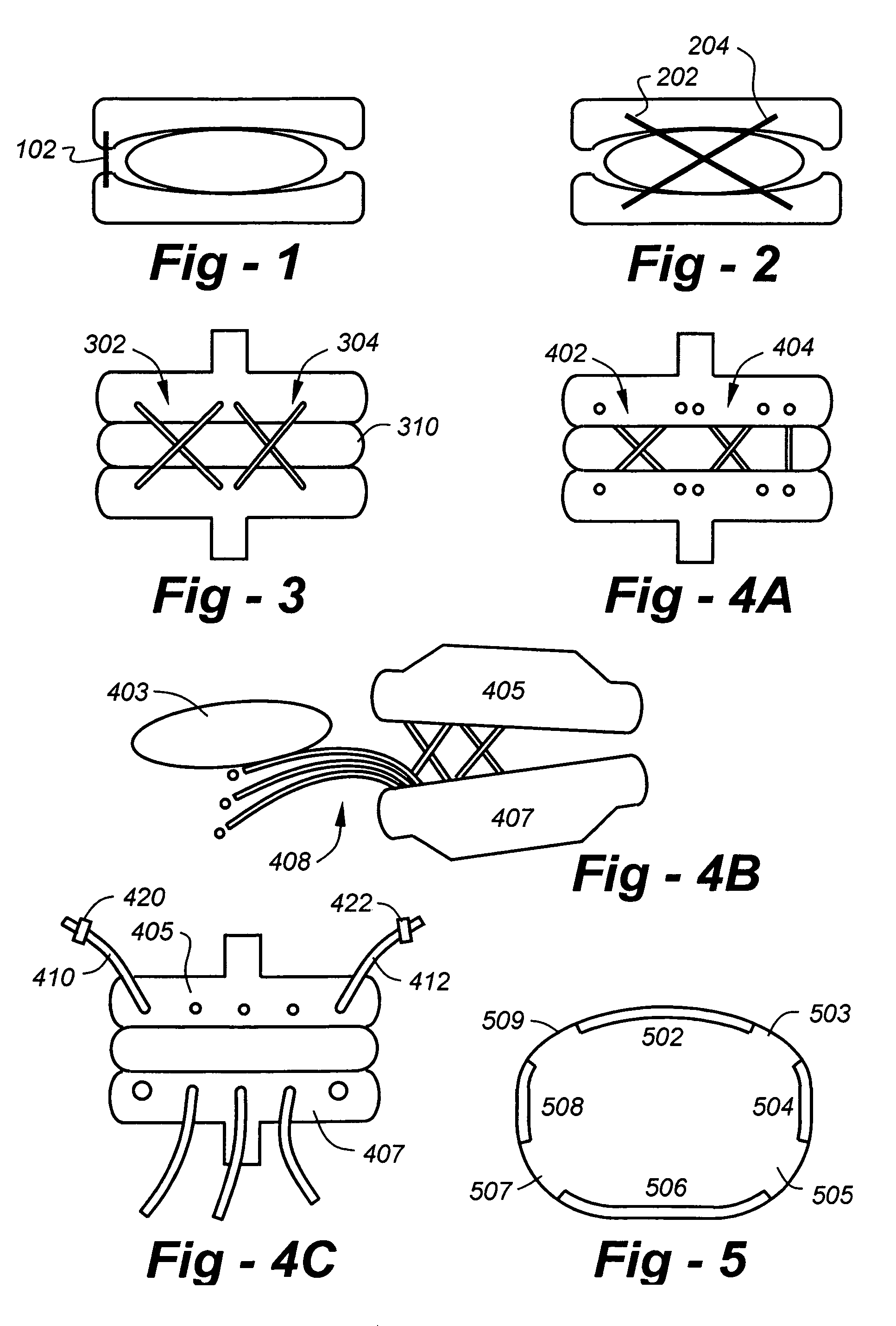 Check reins for artificial disc replacements