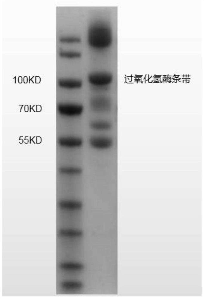 Catalase with high enzyme activity, gene, recombinant strain with high catalase yield and application