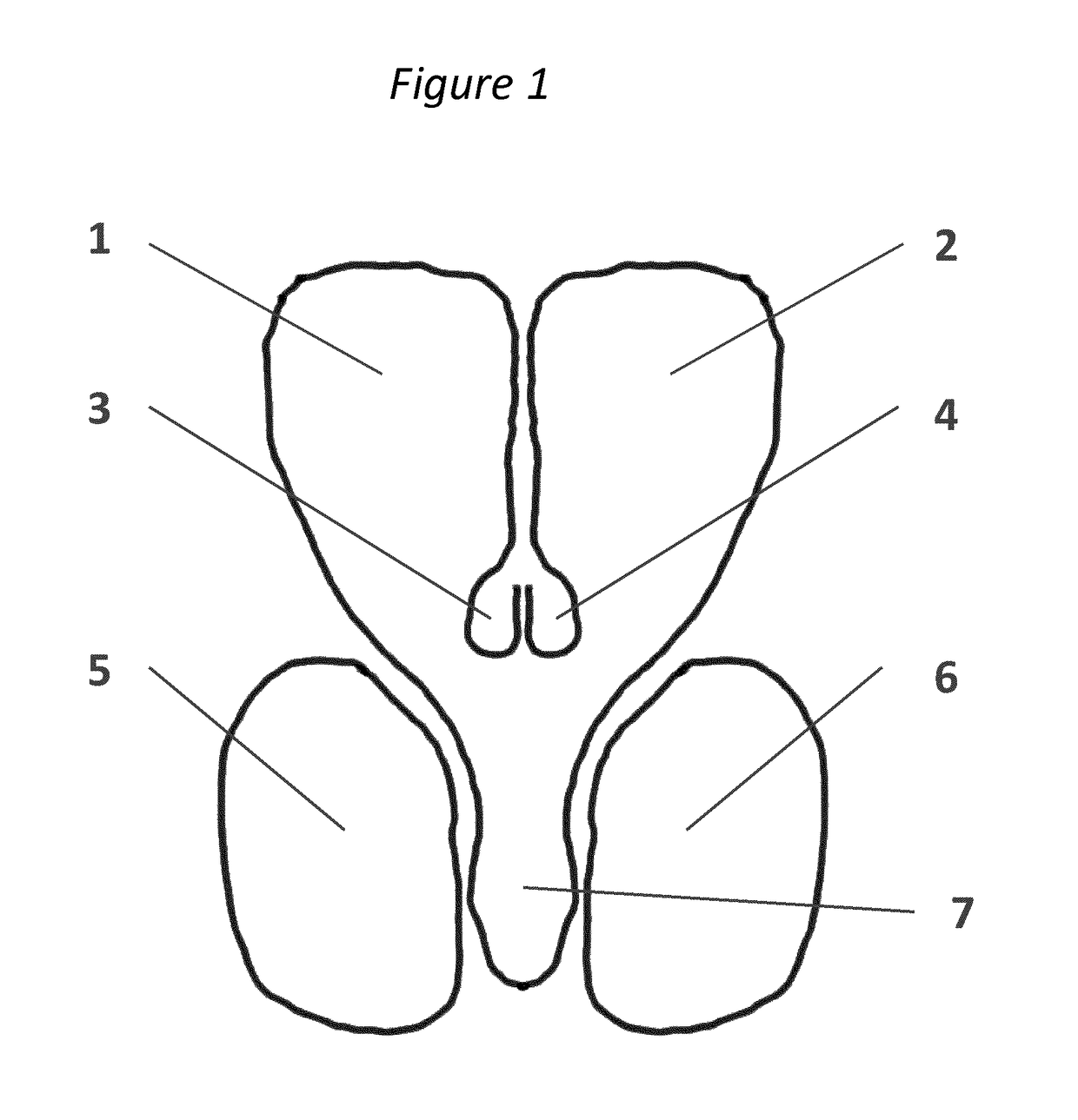 Methods and systems for intraventricular brain stimulation