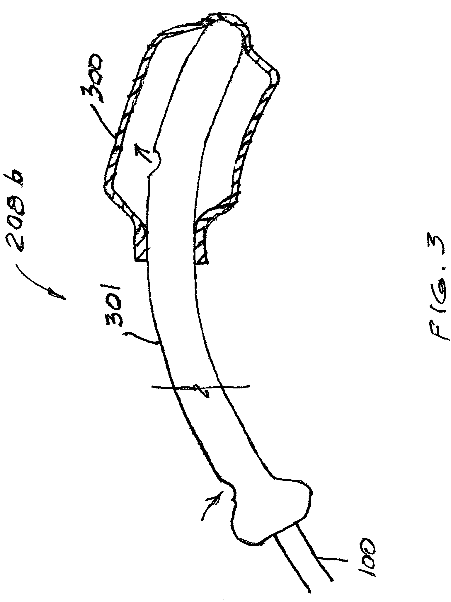 Gynecological brachytherapy applicator and system