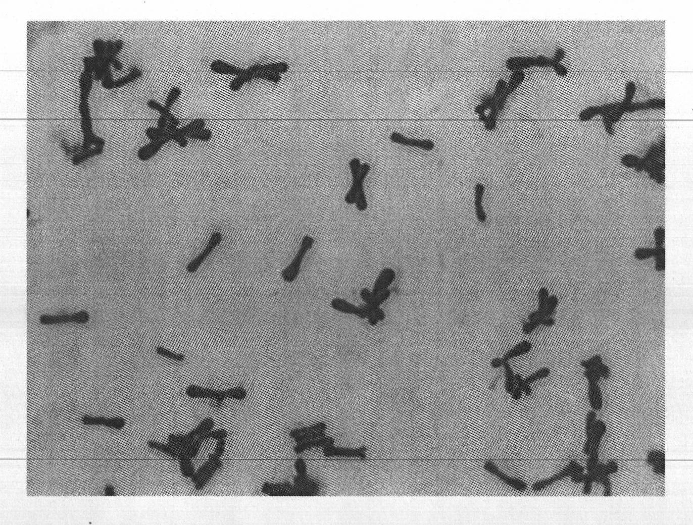 Method for detecting bifidobacterium in sour milk