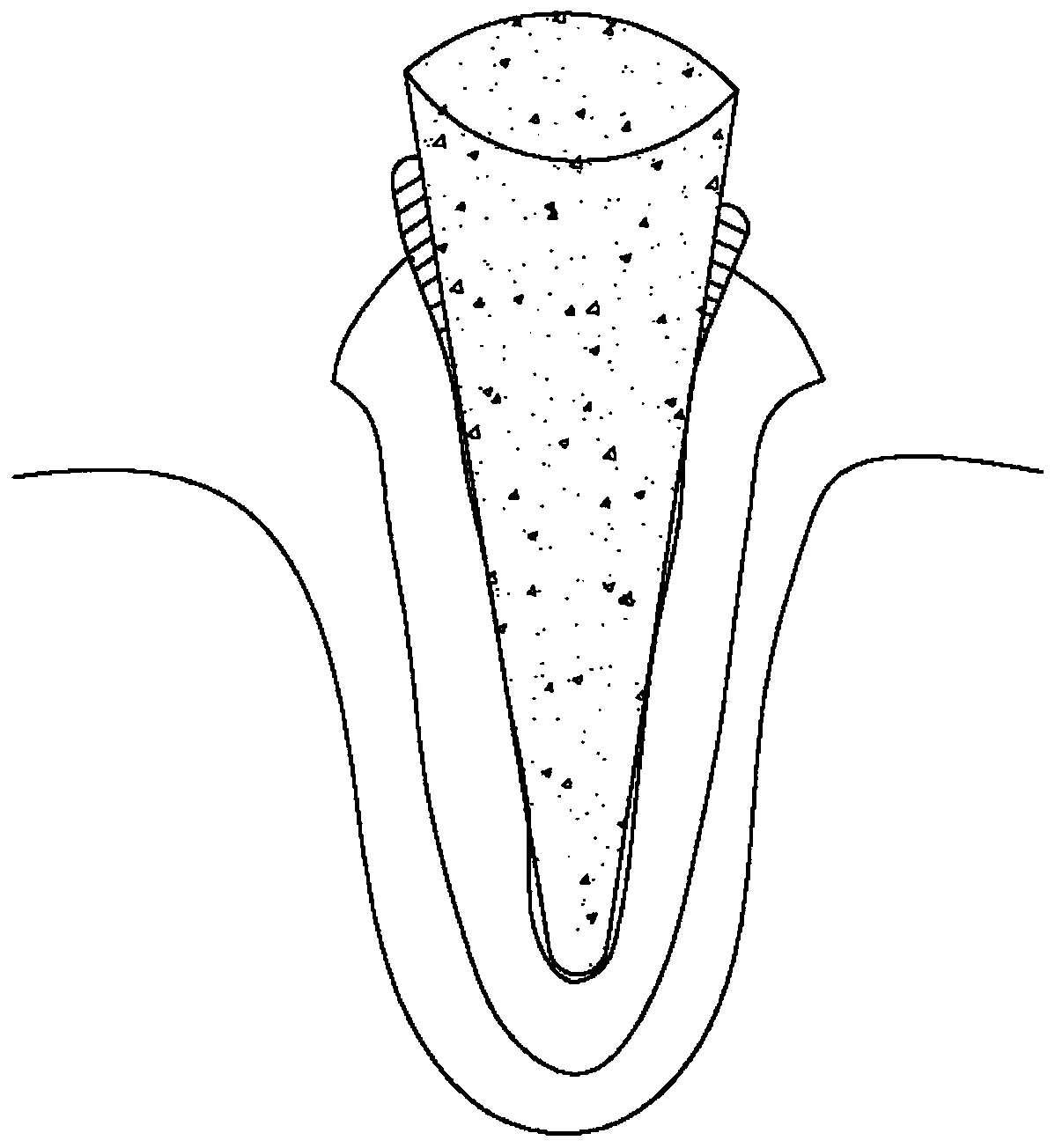 Root canal disinfecting core facilitating clinic operation and preparation method thereof