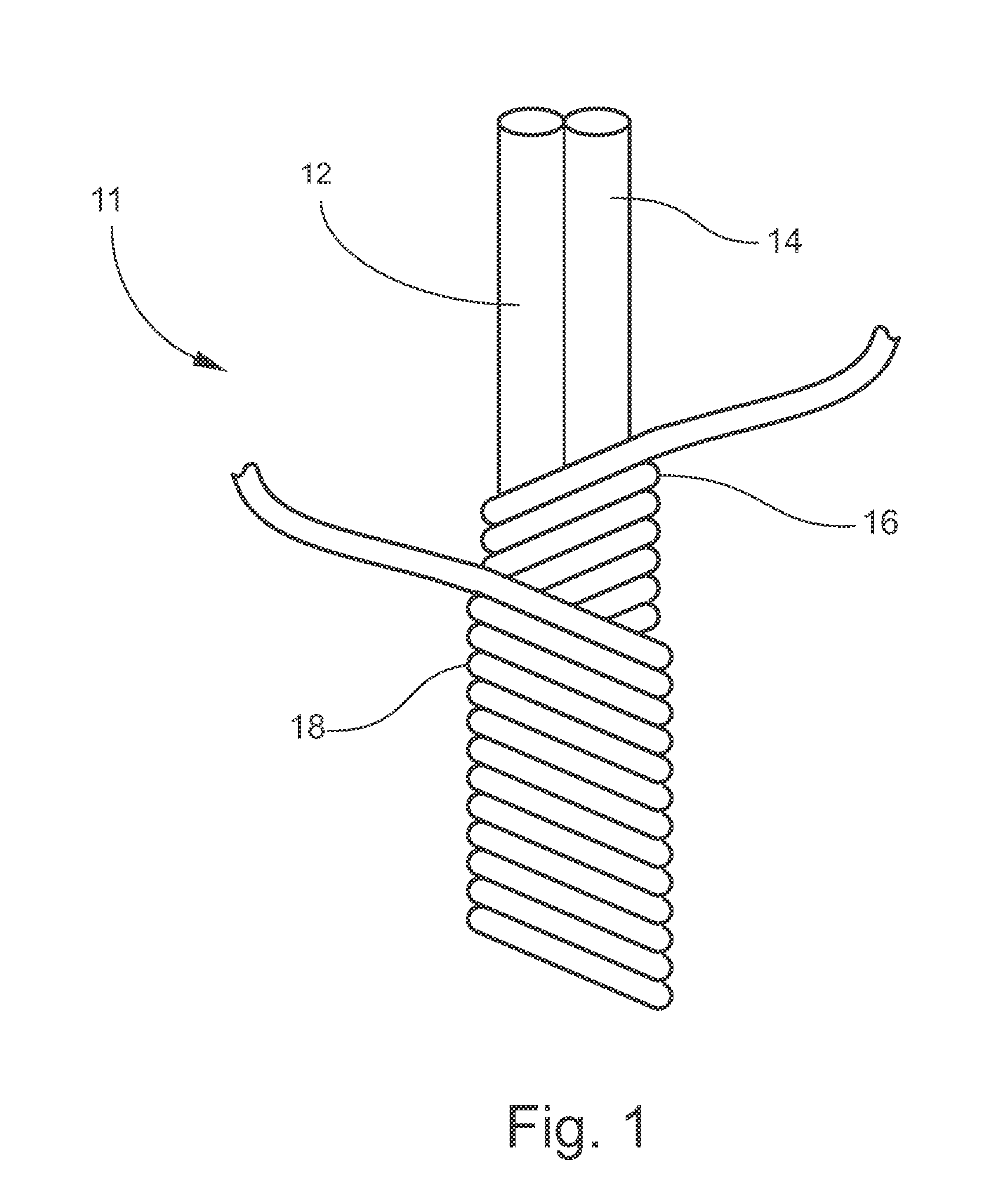 Protective glove with enhanced exterior sections