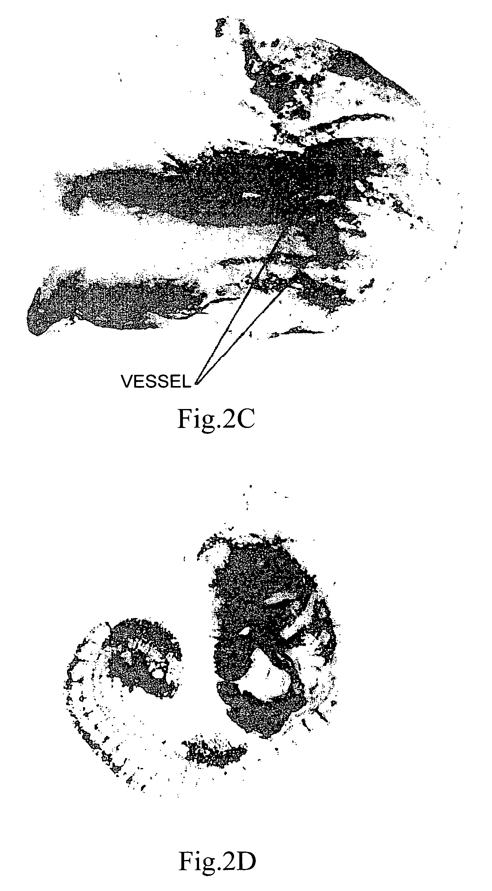 Plexin family-like polypeptide, and uses thereof