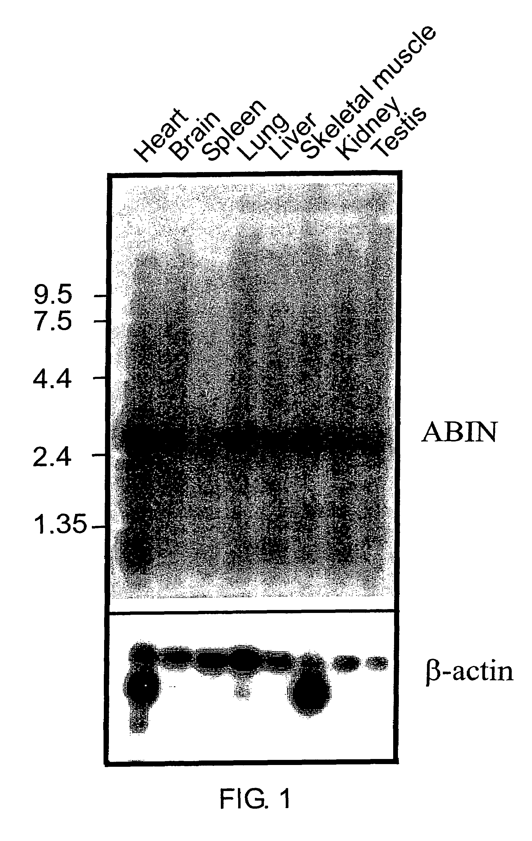 Inhibitors of NF-kappaB activation