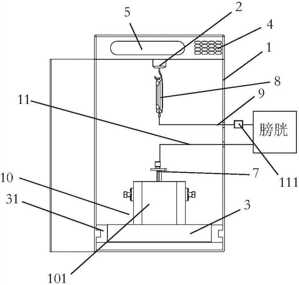 Real-time bladder irrigation urine volume metering device