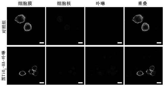 Application of nano material in preparation of medicine for treating atherosclerosis